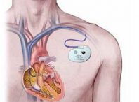طرح توجیهی تولید دستگاه محرک ماهیچه قلب